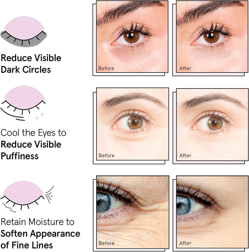 Grace & Stella Award Winning Under Eye Gel Mask